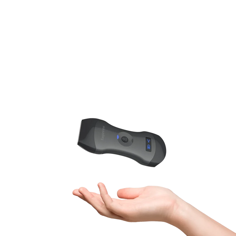 EagleView™ ワイヤレスプローブ型超音波スキャナ