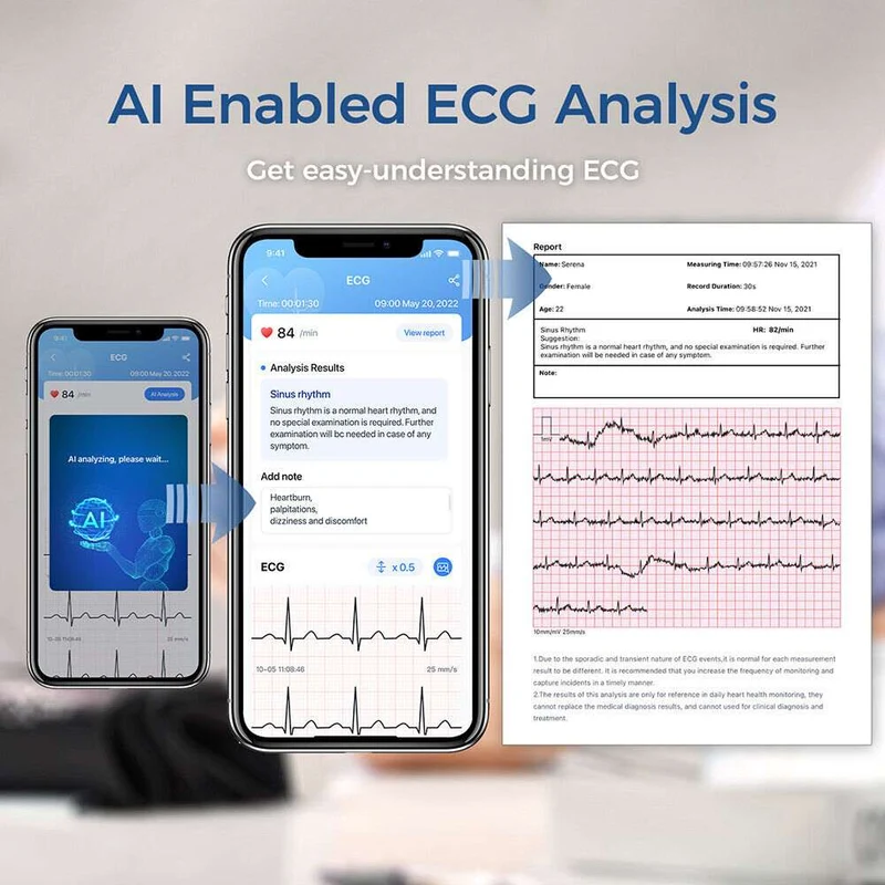 Monitor de presión arterial inalámbrico (BP + EKG)