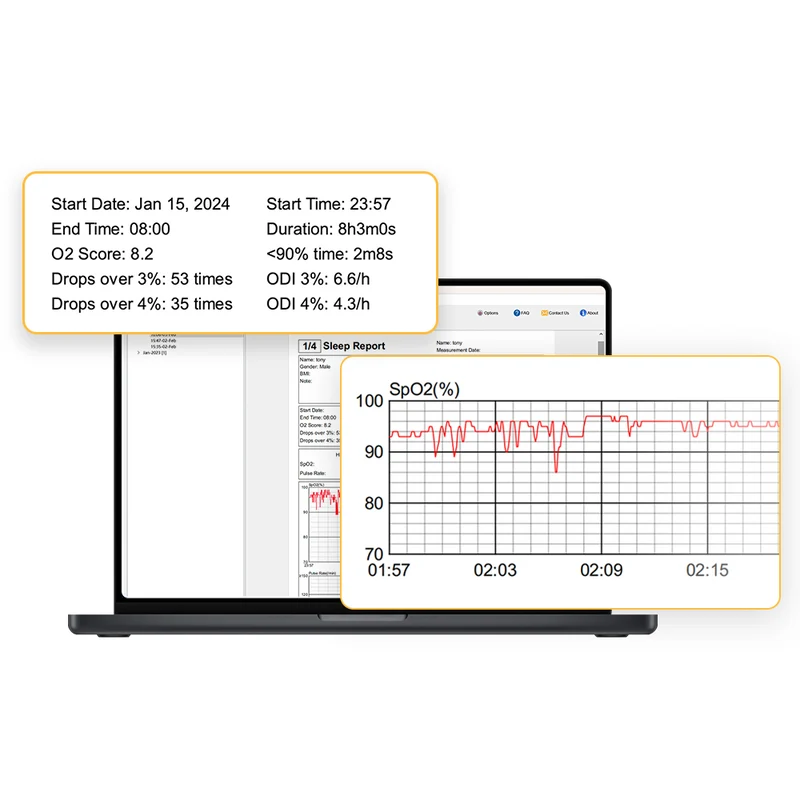 Monitor de oxígeno de anillo continuo O2Ring™ x2