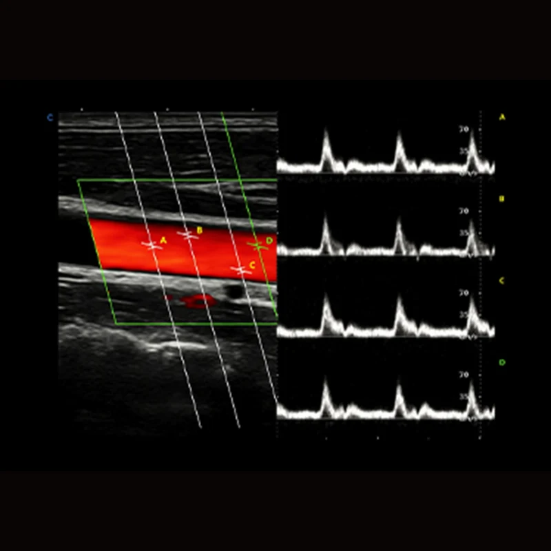 CBit 10 Ultraschallsystem