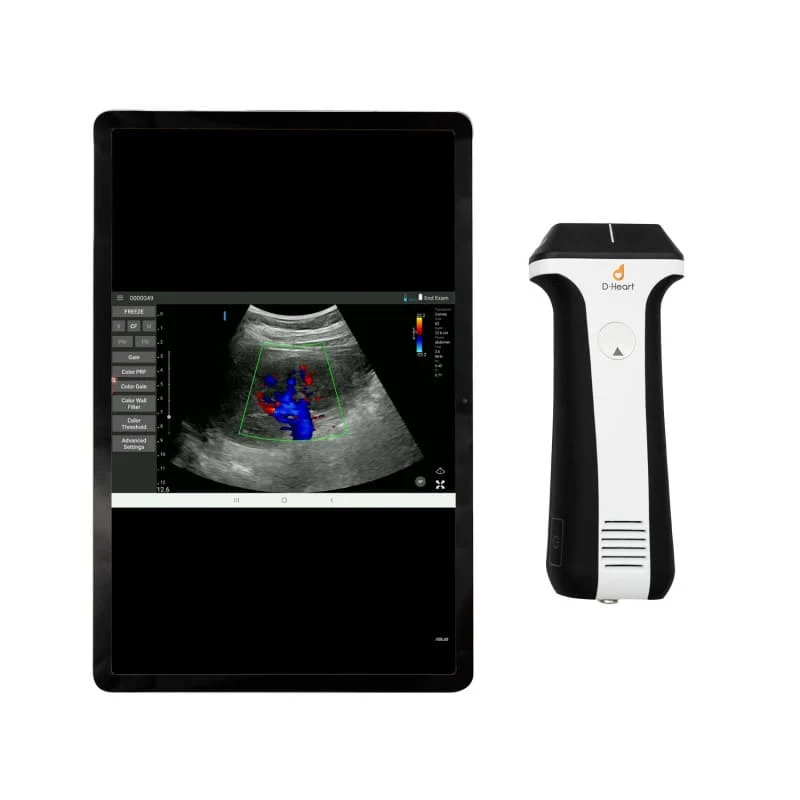 D-Heart handheld Ultraschallgerät