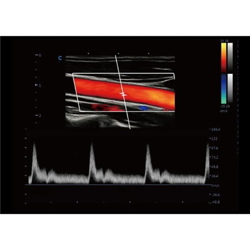 CBit9 Farbdoppler-Ultraschallsystem