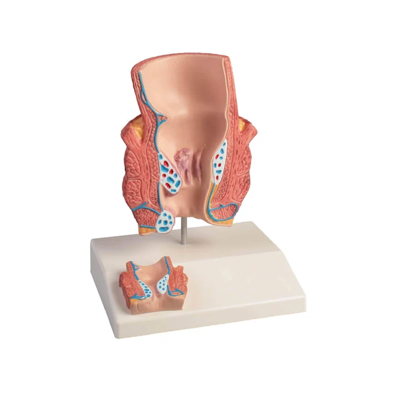 Erler-Zimmer Hämorrhoidenmodell 2 fache Größe