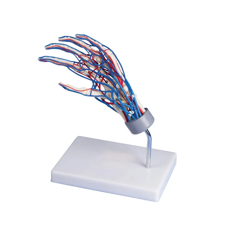 Erler-Zimmer Gefäßhand Modell
