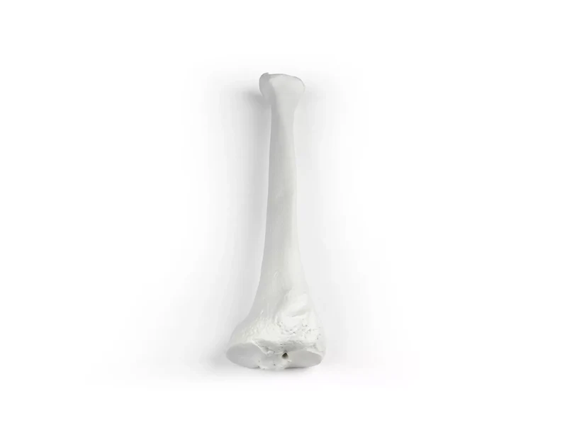 Erler-Zimmer Schienbein Modell Tibia