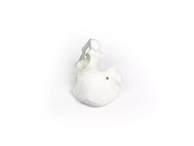 Erler-Zimmer Beckenhälfte Modell