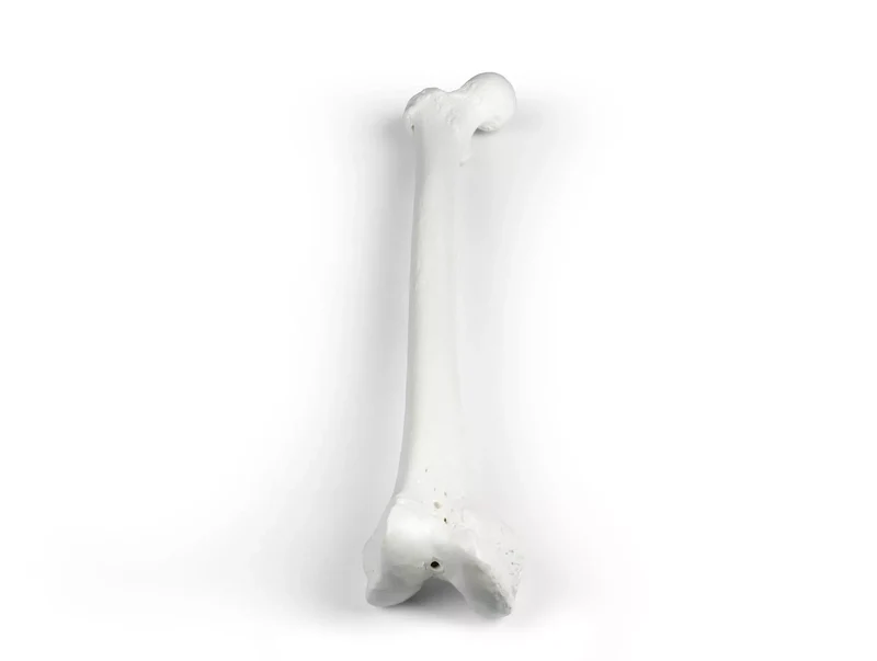 Erler-Zimmer Oberschenkel Modell Femur