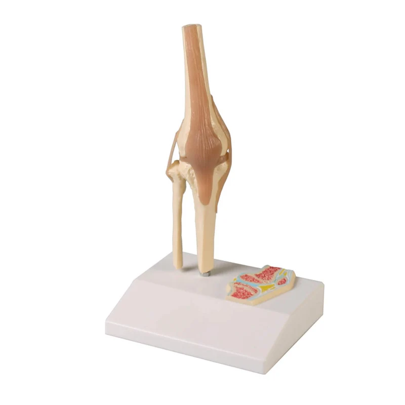 Erler-Zimmer Mini Kniegelenkmodell mit Querschnitt