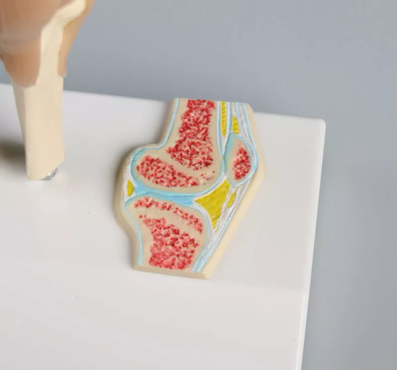 Erler-Zimmer Mini Kniegelenkmodell mit Querschnitt