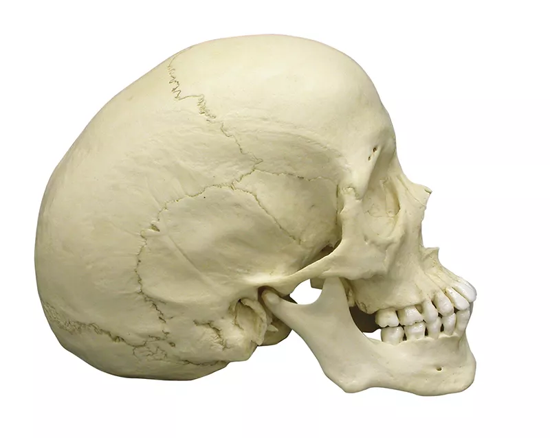 Erler-Zimmer Skaphozephaler Schädel Modell