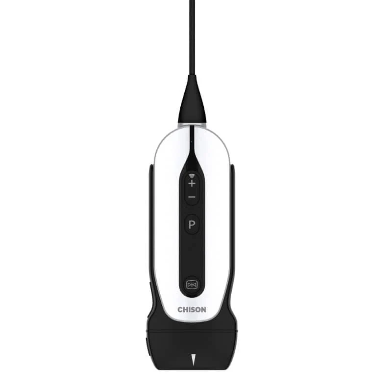 Chison portables Ultraschallgerät «SonoEye»