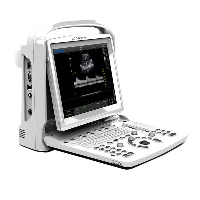 CHISON ECO3 Expert Ultraschallgerät
