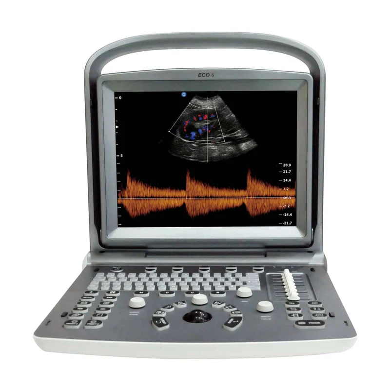 Chison ECO 6 Ultraschallgerät