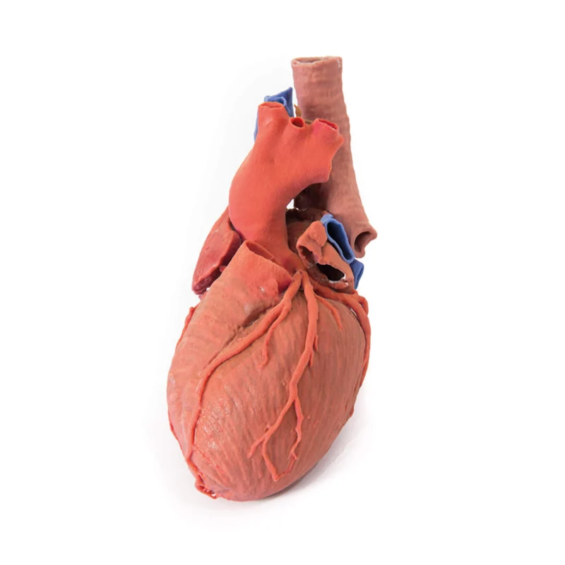 Erler-Zimmer Herz und distale Trachea, Carina tracheae und Primärbronchien