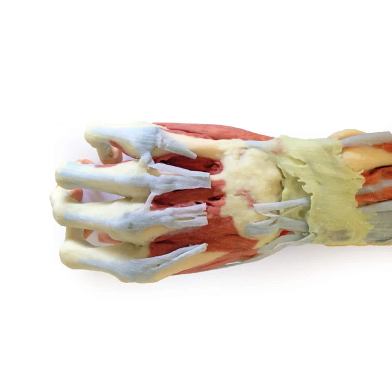 Erler-Zimmer Tiefe Präparation der oberen Extremität und Hand