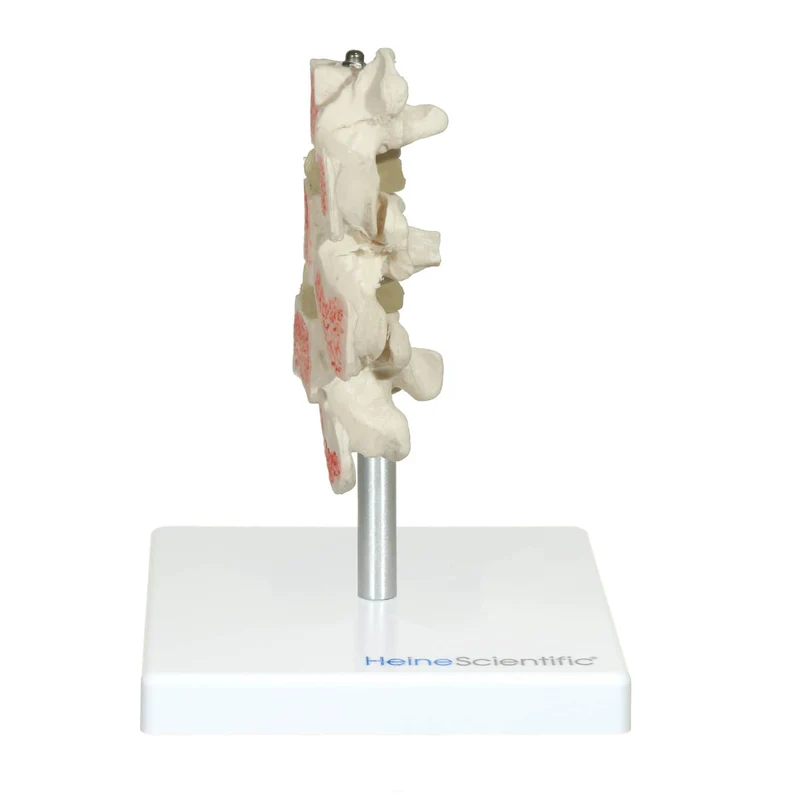 Osteoporose Modell